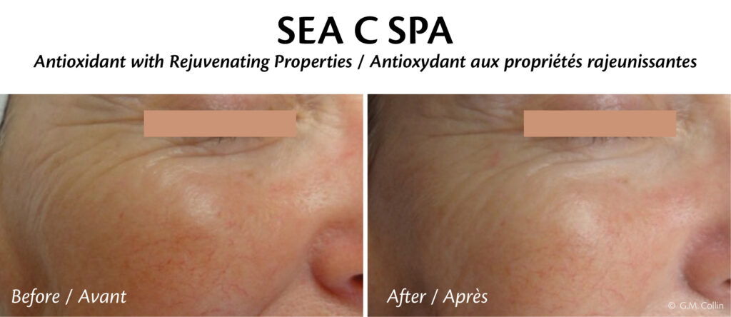 A before and after picture of sea c spa 's skin rejuvenation.